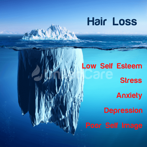 Hair Loss is a Tip of an Iceberg - Low Self Esteem, Stress, Anxiety, Depression, Poor Self Image