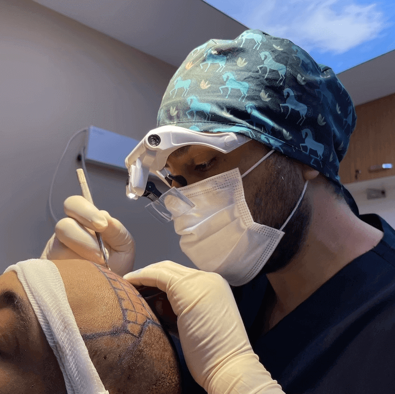 Executing the hair transplant surgery plan