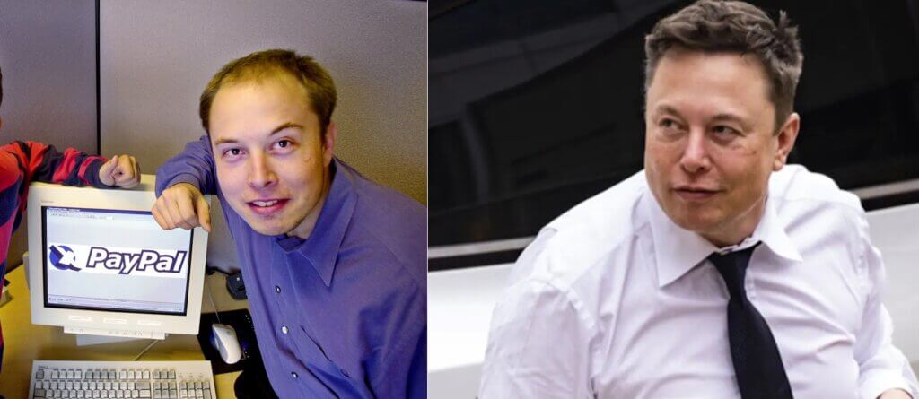 Elon Musk's Before and After Transformation of Hairline