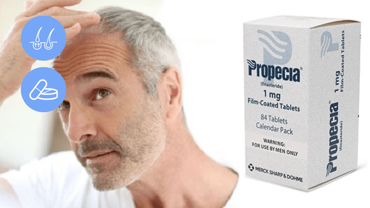 Hair Transplant Without Finasteride How Possible Is It