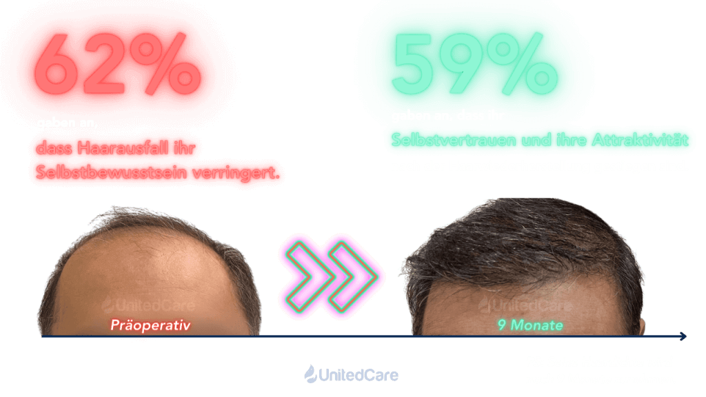 Männer Haartransplantation Umfrage Selbstwertgefühl und Attraktivität Ergebnis